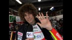 Simoncelli explains hand condition
